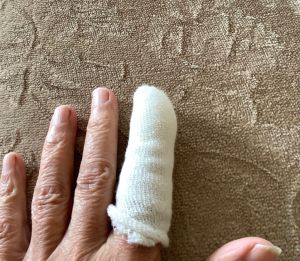 damaged finger
